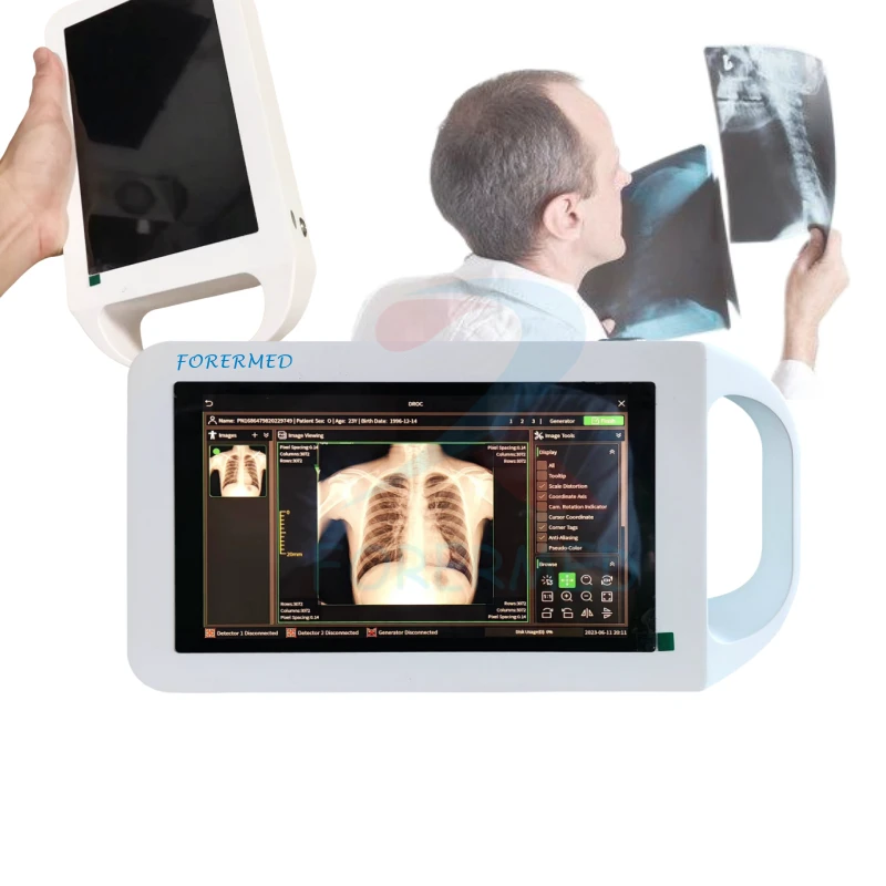 ราคาสแกนเนอร์ X Ray Handheld