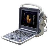 ดิจิตอลแบบพกพา 4 3D USG สี Doppler