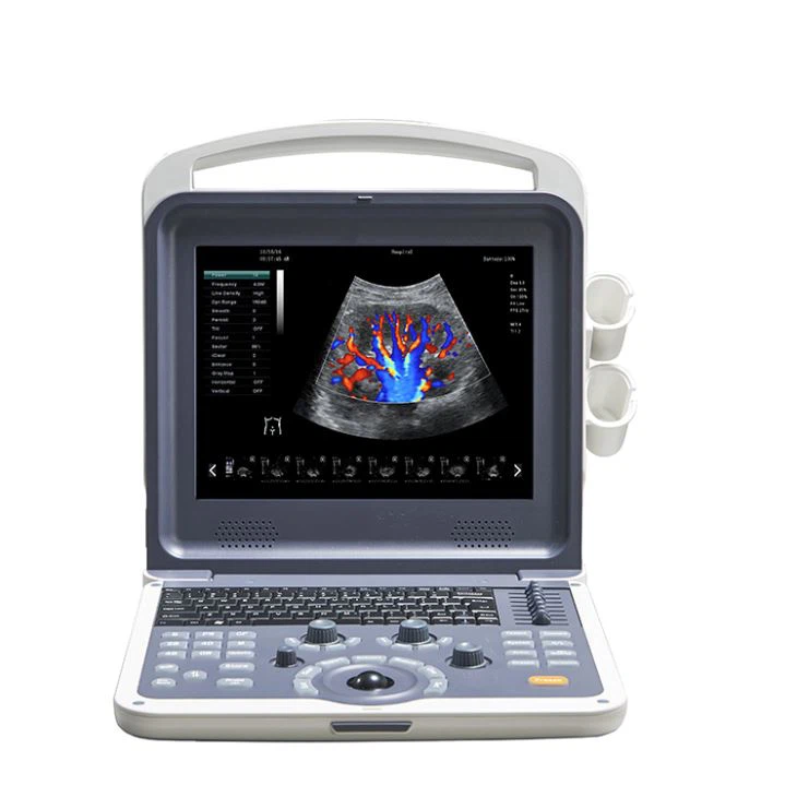 เครื่องสแกน Doppler สีแบบพกพา 3D / 4D