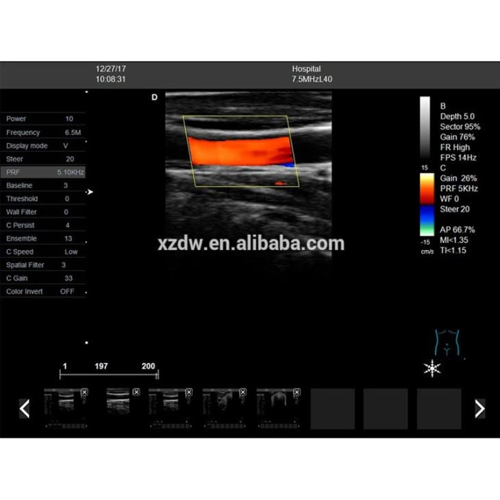 4D Digital Ultrasound Transducer 4D Digital Ultrasound Transducer