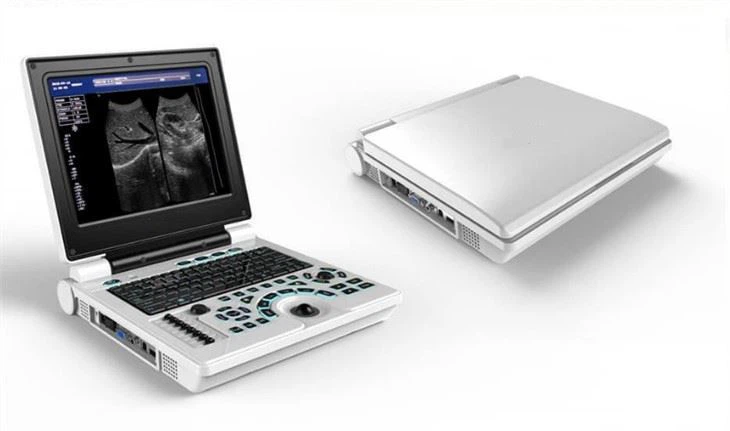 Portable Ultrsound Diagnostic System Portable Ultrsound Diagnostic System