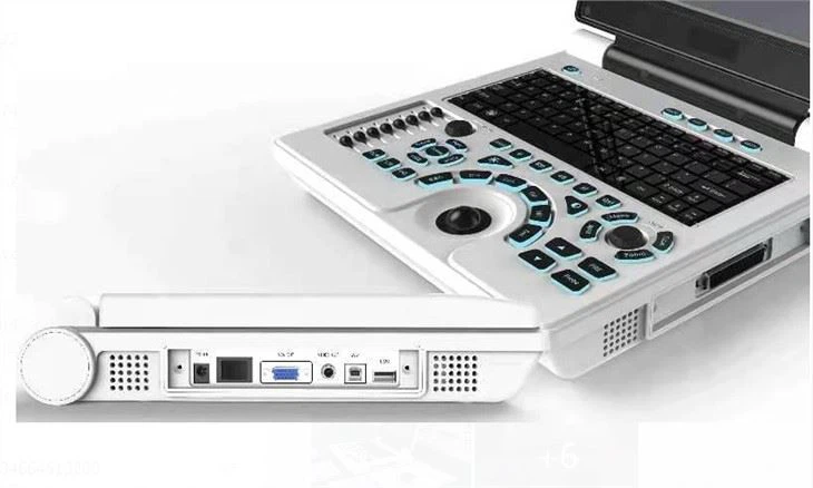 Portable Ultrsound Diagnostic System Portable Ultrsound Diagnostic System