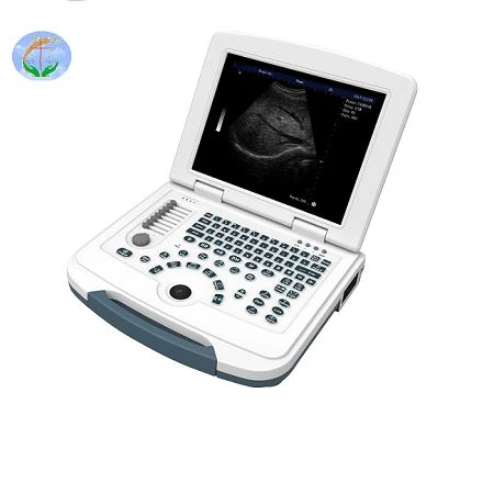 Black And White Laptop Ultrasound Scanner Black And White Laptop Ultrasound Scanner