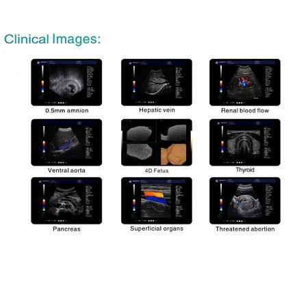 Full Digital Color Doppler Ultrasound Diagnostic System Full Digital Color Doppler Ultrasound Diagnostic System