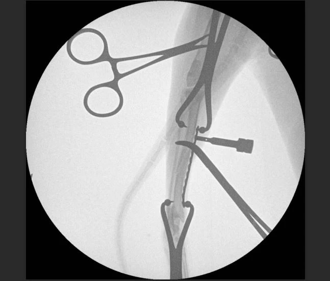 VET High Frequency Mobile C-arm System Surgical VET High Frequency Mobile C-arm System Surgical