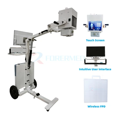 The 5KW/P8KW Portable Digital X-ray